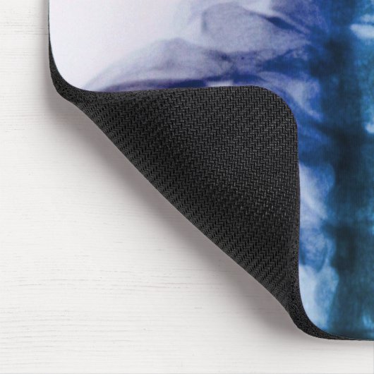 デジタル頚部X線の芸術 マウスパッド (コーナー)