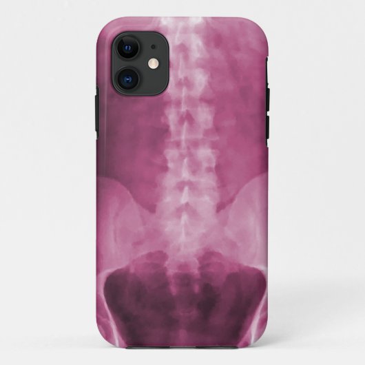 デジタルX線の芸術のiPhone 5の場合 Case-Mate iPhoneケース (裏面)