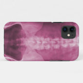 デジタルX線の芸術のiPhone 5の場合 Case-Mate iPhoneケース (裏面(横))
