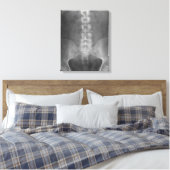 デジタルX線アートキャンバスプリント キャンバスプリント (インサイチュ (寝室))