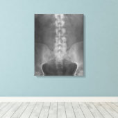 デジタルX線アートキャンバスプリント キャンバスプリント (インサイチュ (ウッドフロア))