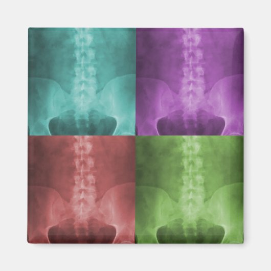 デジタルX線アートマグネット マグネット (正面)