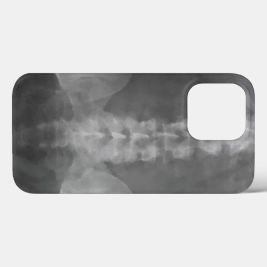 デジタルX線アート Case-Mate iPhoneケース (裏面 (横))