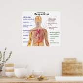 デング熱の主な症状の図 ポスター (キッチン)