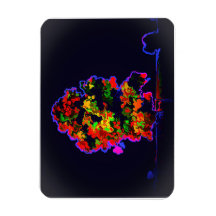 ネオンの木の爆発