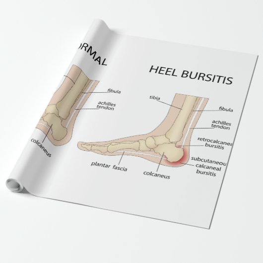 ハグルンド奇形 ラッピングペーパー (アンロールド)