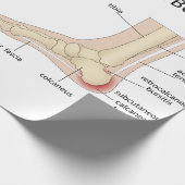 ハグルンド奇形 ラッピングペーパー (角)