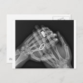 ハンドホールド ポストカード (正面/裏面)