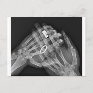 ハンドホールド ポストカード