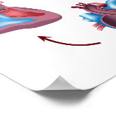 ハート弁操作ポスター ポスター (角)