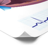 ハート病心房細動ポスター ポスター (角)