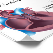 ハート筋ポスターの病気 ポスター (角)