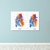 ハート血流医療図 キャンバスプリント (インサイチュ (ウッドフロア))