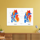 ハート血流医療図 キャンバスプリント (インサイチュ (リビング))