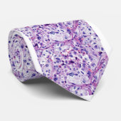バレンタインの多形性の肉腫 ネクタイ (ロール)