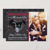 バレンタインの妊娠告知の超音波カード シーズンカード (正面/裏面)