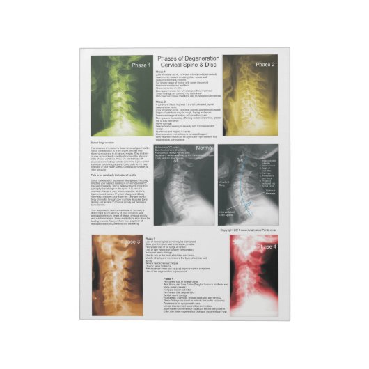 パッド頸部脊髄変性を引き裂く ノートパッド (回転)