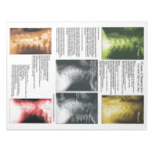 パッド頸部脊髄変性を引き裂く ノートパッド (正面)