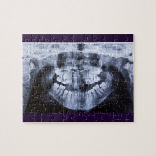 パノラマで撮影された女の子のX線 ジグソーパズル (横)