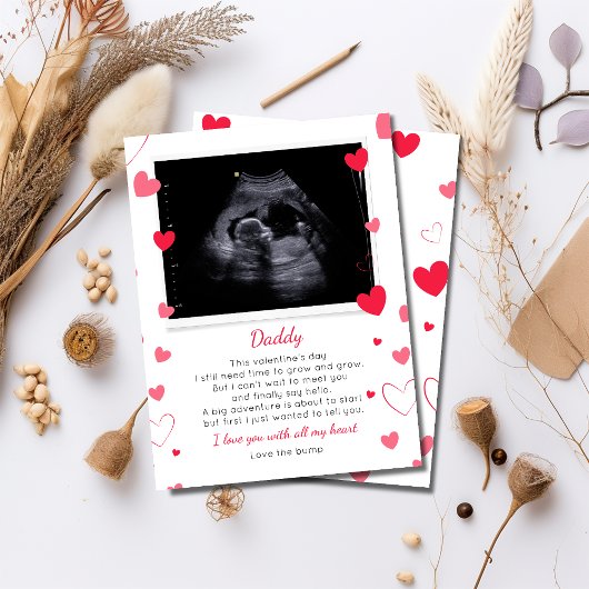 パパへのバレンタイン　ママのおなかから