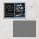 パパをBumpからDaddyに昇格笑わされる: 父の 紹介カード (正面/裏面)