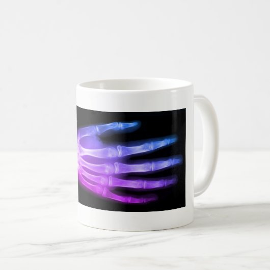 パーソナライズなピンクの手首または手のX線 コーヒーマグカップ (正面右)