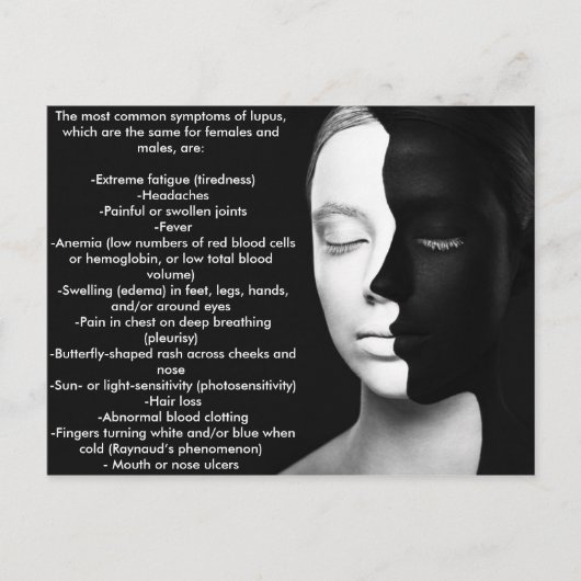 パートナー静かルパス… ポストカード (正面)