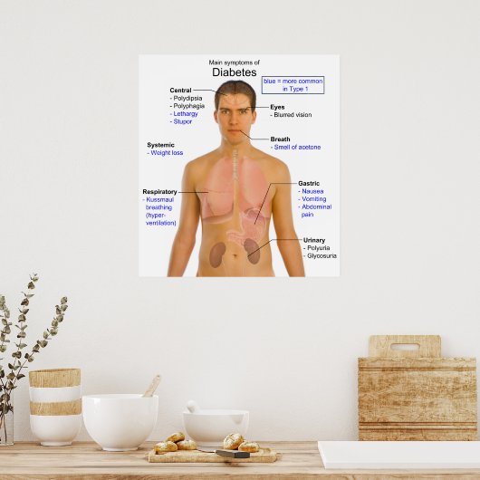 ヒトにおける糖尿病の主な症状の図 ポスター (キッチン)