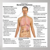 ヒトにおける細菌感染のポスター表 ポスター (正面)