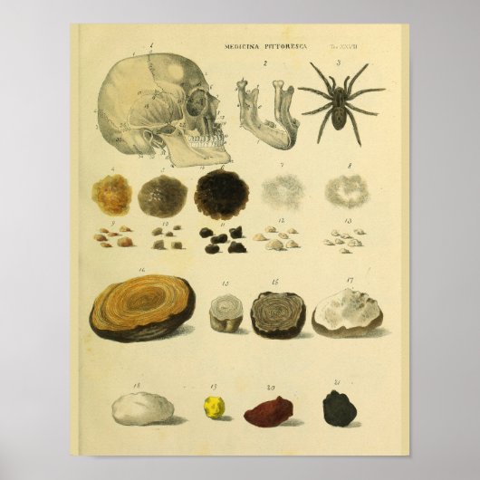 ヒトスカルスパイダー医療解剖学アートプリント ポスター (正面)