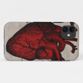 ヒトハート症例群 Case-Mate iPhoneケース (裏面(横))