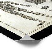 ヒト動脈解剖学ヴィンテージプリント ポスター (角)