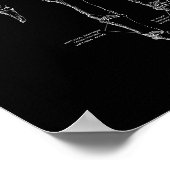 ヒト手骨解剖学イラストレーション古医療 ポスター (角)