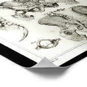 ヒト脊椎骨盤解剖学プリント ポスター (角)