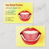 ビッグマウス黄色金ゴールドプロフェッショナル歯科 名刺 (正面/裏面)