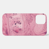 ピンクと黒のフローラ織り Case-Mate iPhoneケース (裏面 (横))