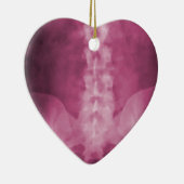 ピンクのデジタルX線の芸術のオーナメント セラミックオーナメント (右)