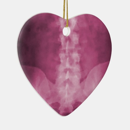 ピンクのデジタルX線の芸術のオーナメント セラミックオーナメント (右)