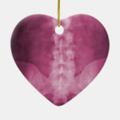 ピンクのデジタルX線の芸術のオーナメント セラミックオーナメント (裏面)