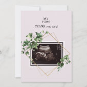 ピンクの超音波写真ありがとうベビーの視点 サンキューカード (正面)