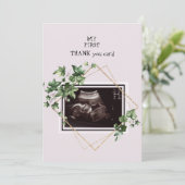 ピンクの超音波写真ありがとうベビーの視点 サンキューカード (スタンド正面)