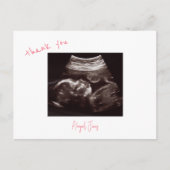 ピンクベビーシャワー超音波 ポストカード (正面)