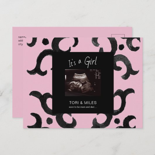 ピンク女の子の超音波写真が到着する予定 案内ポストカード (正面/裏面)