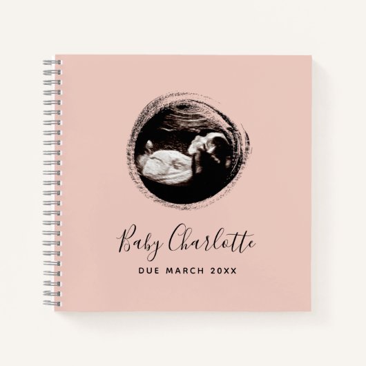 ピンク・ベビーガール・ソノグラム超音波妊娠図 ノートブック (正面)