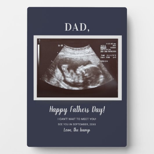ファーザーズデイスクリプトベビー超音波写真パパ フォトプラーク (正面)