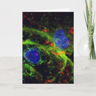 フィブリノゲンの挨拶状 カード