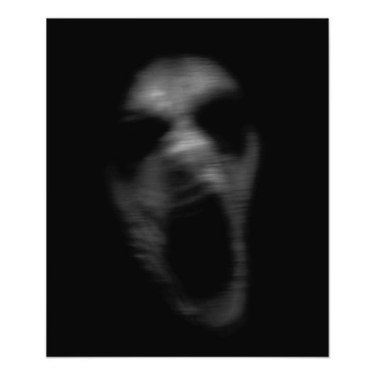 フォールン精神障害 フォトプリント (正面)