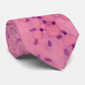 フックス・ジストロフィー・タイ ネクタイ (ロール)