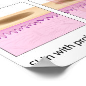 フラクショナルレーザー皮膚再生ポスター ポスター (角)