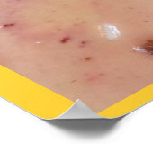 フルーツとトーストフランスのー ポスター (角)